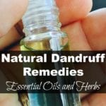 Natural Dandruff Remedy - essential oils and herbs from Simple Life Mom