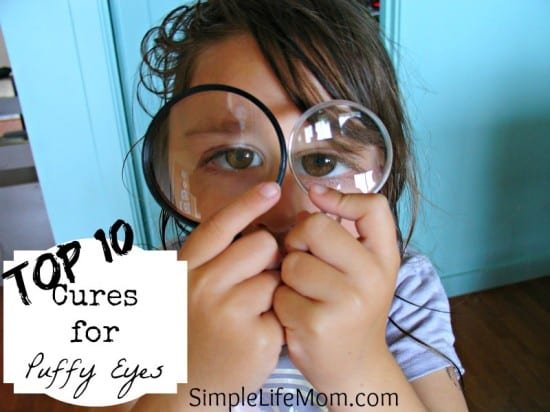 Top 10 Cures for puffy eyes- Possible causes, Do's and Don'ts, and top 10 methods to cure puffy eyes