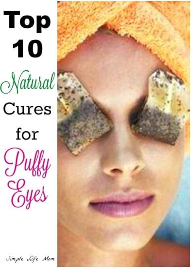 Top 10 Cures for Puffy Eyes from Simple Life Mom