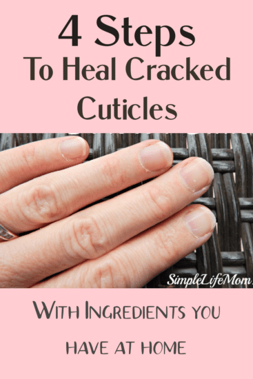 4 Ways to Heal Cracked Cuticles
