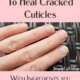 4 Steps to Heal Cracked Cuticles with Natural Ingredients