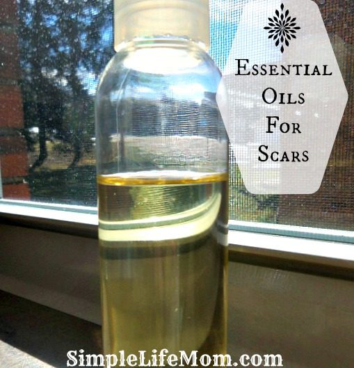 Essential Oils for Scars by Simple Life Mom