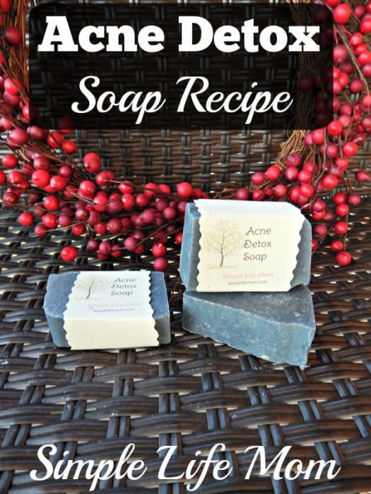 Acne Detox Soap Recipe