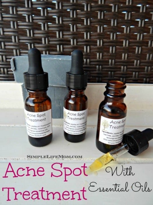 Acne Spot Treatment with Essential Oils by Simple Life Mom. Oils to cleanse, heal, and reduce inflammation.