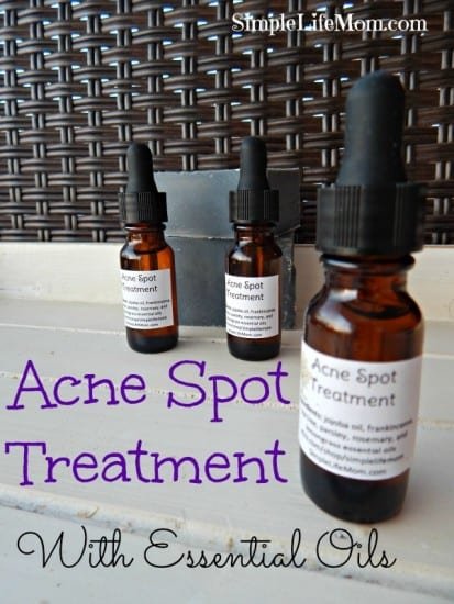 Acne Treatment and Essential Oils