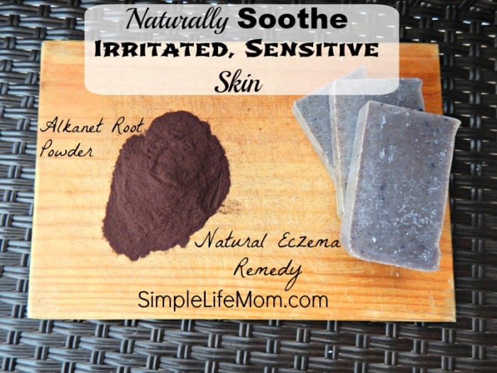 Naturally Soothe Irritated Sensitive Skin by SimpleLifeMom.com
