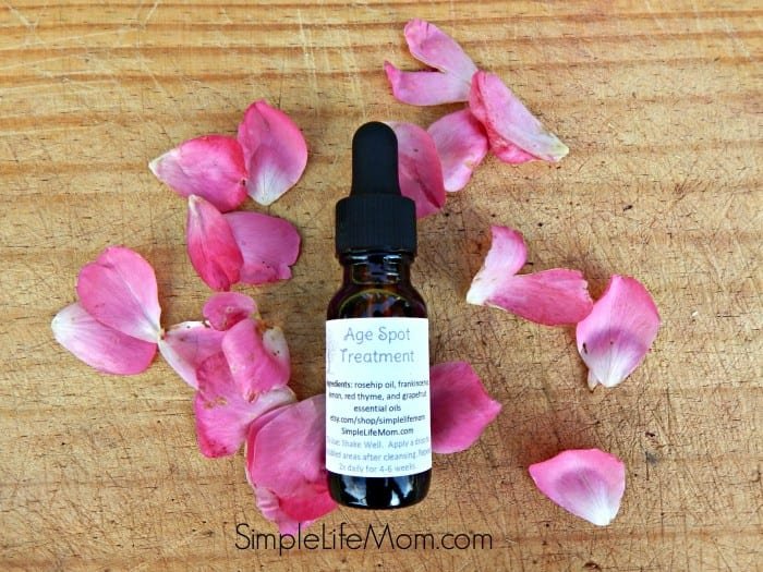 Natural Age Spot Serum Recipe for Skin Lightening from Simple Life Mom using Essential Oils