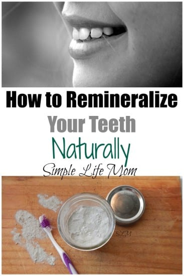 How to Remineralize Your Teeth Naturally from Simple Life Mom