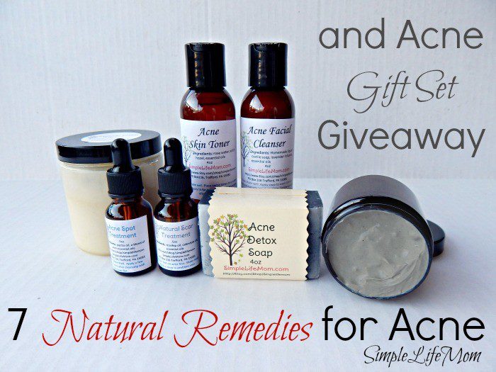 7 Natural Remedies for Acne and Gift Set Giveaway from Simple Life Mom