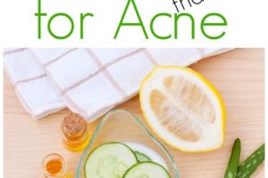 7 Natural Remedies for Acne that work from Simple Life Mom