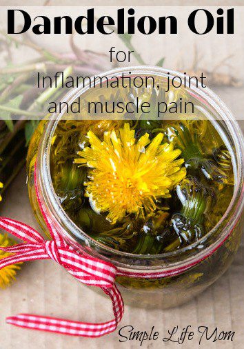Dandelion Oil for Inflammation and Sore Joints from Simple Life Mom