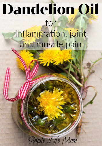 Dandelion Oil for Inflammation and Sore Joints from Simple Life Mom