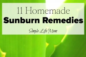 11 Homemade Sunburn Remedies - natural ingredients only