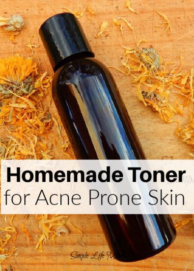 Homemade Toner for Acne Prone Skin from Simple Life Mom