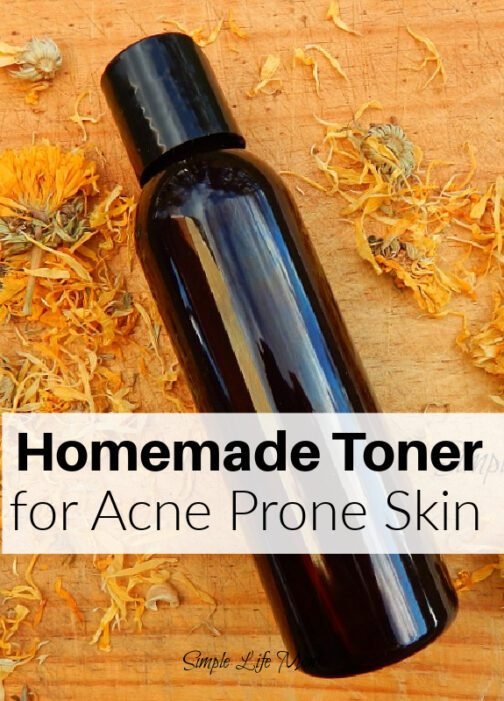 How to Make Homemade Toner for Acne Prone Skin Simple Life Mom