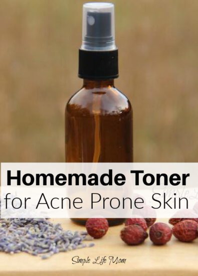 Homemade Toner for Acne Prone Skin from Simple Life Mom