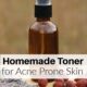 How to Make Homemade Toner for Acne Prone Skin